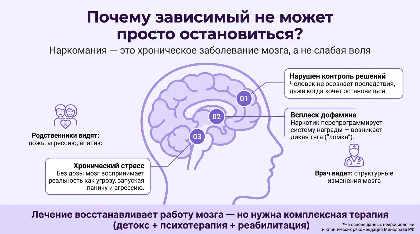 Наркоманы Инфографика анатомии наркотической зависимости. Изображение человеческого мозга